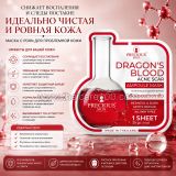 Тканевая маска для лица от постакне и следов после прыщей Precious Skin Dragon’s Blood Acne Scar Ampoule Mask 